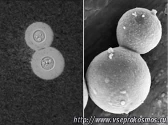 Грибы Cryptococcus neoformans